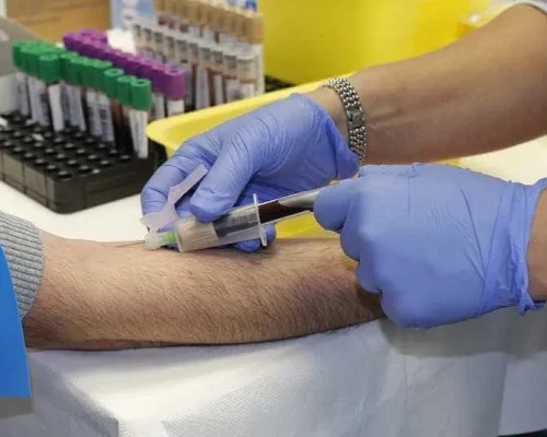 Alerta de Saúde: Mais de 70% dos Brasileiros Ignoram Check-ups Anuais, Colocando a Vida em Risco