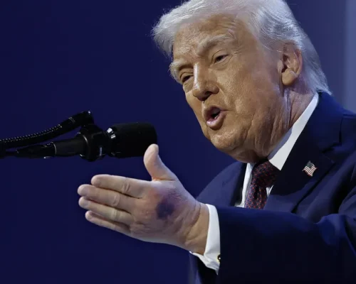 Aspirina, hematomas e saúde “perfeita”: Manchas em Trump chamam atenção