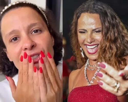 Alopecia em Famosos: Estrelas da TV e Música Que Enfrentam a Perda de Cabelo e Podem Ficar Carecas