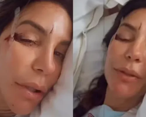 Ivete Sangalo é hospitalizada às pressas após passar mal com virose e desmaiar: ‘Caí no chão com tudo’