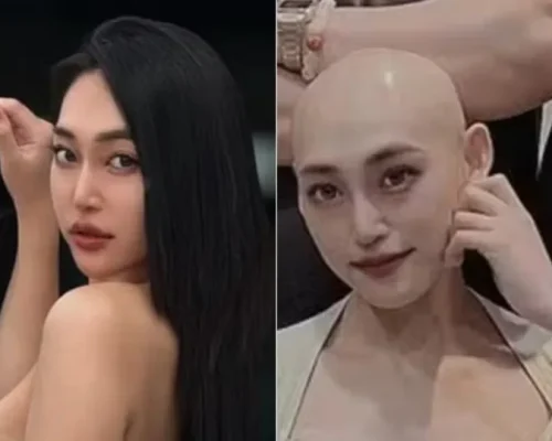 Influenciadora Taiwanesa Wang Wei-Chien Morre Aos 29 Anos Após Confundir Câncer com Lesão e Inspirar Milhares