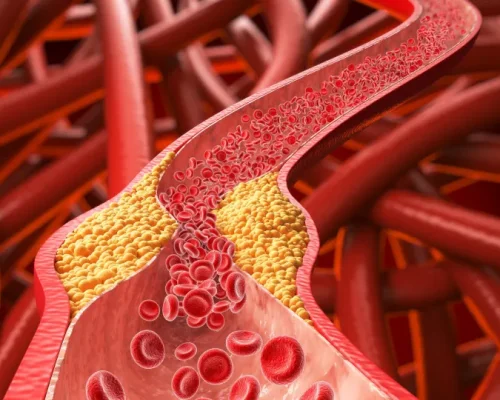 Aveia e Fitosteróis: Alimentos Comuns que Podem Ajudar a Derrubar o Colesterol Ruim e Proteger seu Coração