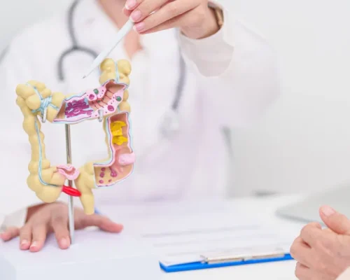 Câncer Colorretal: 7 Hábitos Diários Essenciais para Reduzir o Risco e Proteger sua Saúde Intestinal