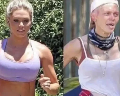 De passarelas ao lixo: A chocante transformação de ex-modelo que virou notícia ao ser flagrada revirando lixo em busca de comida