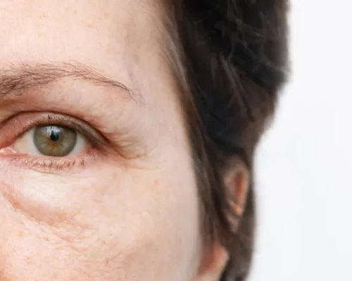 Corpo Envelhecendo Mais Rápido Que o Normal? Descubra os Sinais de Alerta e Como o Estilo de Vida Impacta Seu Relógio Biológico